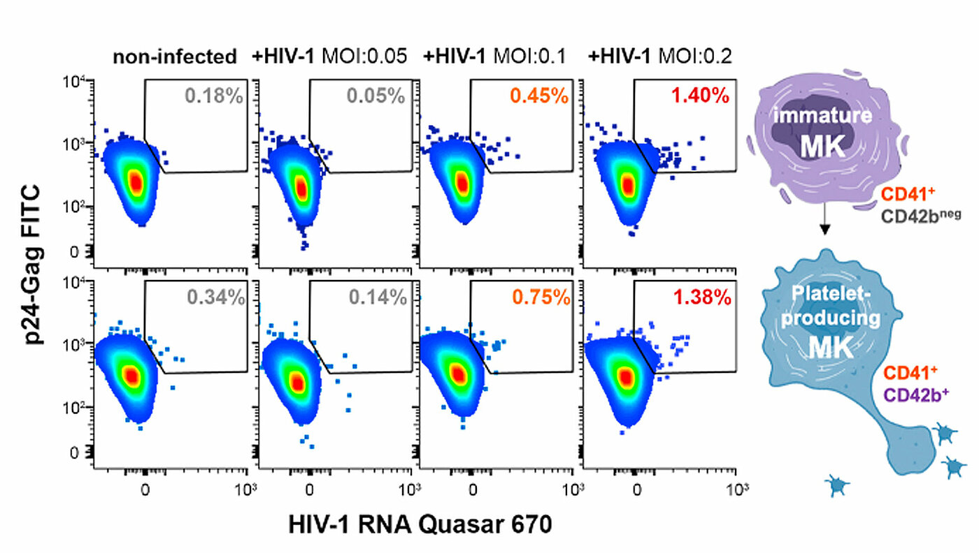 Infection des HSPC par le VIH-1 et héritage par les MK