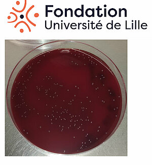 Bordetella holmesii colonies on Bordet Gengou agar plates suppleted with 10% sheep blood