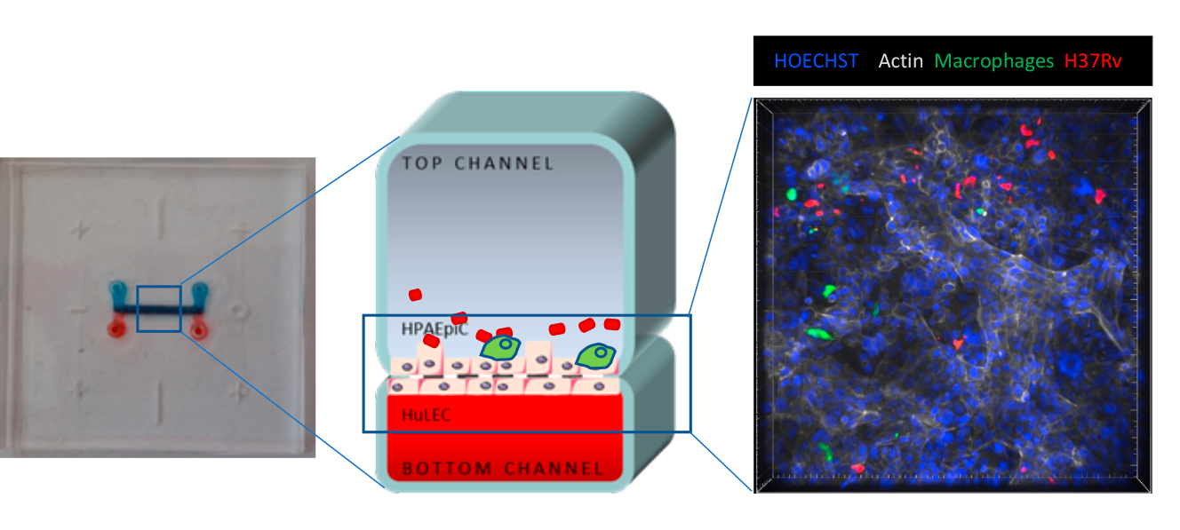 Pulmonary alveolar-on-a-chip model